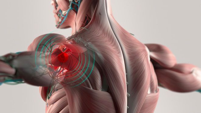 Shoulder Pain - The Workout Crusher | ATHLEAN-X