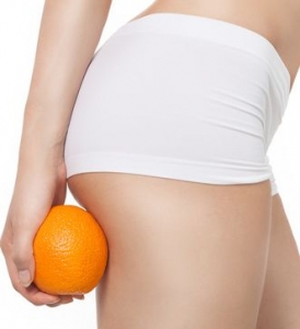 Cellulite: Creams, Treatments and Surgeries, Oh My!  What REALLY Works to Get Rid of It?