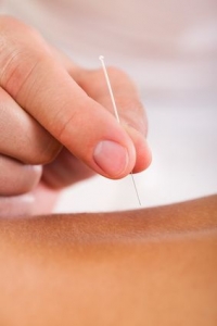 acupuncture sports injuries