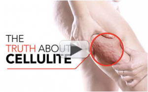 Cellulite-play