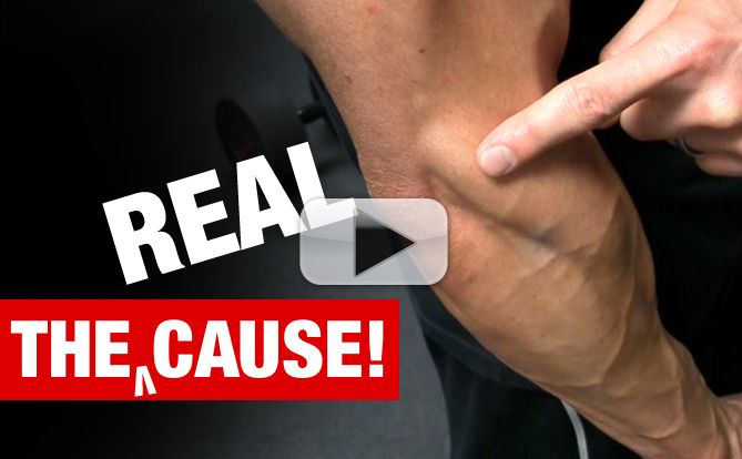 tennis-elbow-cause-and-exercises-yt-pl