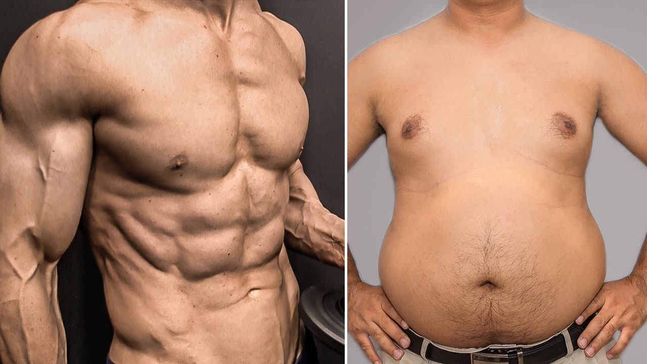 how to lose chest fat vs gynecomastia in men