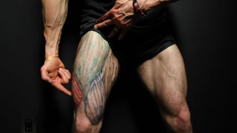 vastus lateralis