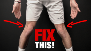 How to Fix Knee Valgus (KNEES THAT CAVE IN!)