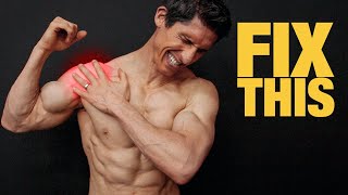 How to Fix Shoulder Pain | Impingement (FOREVER)