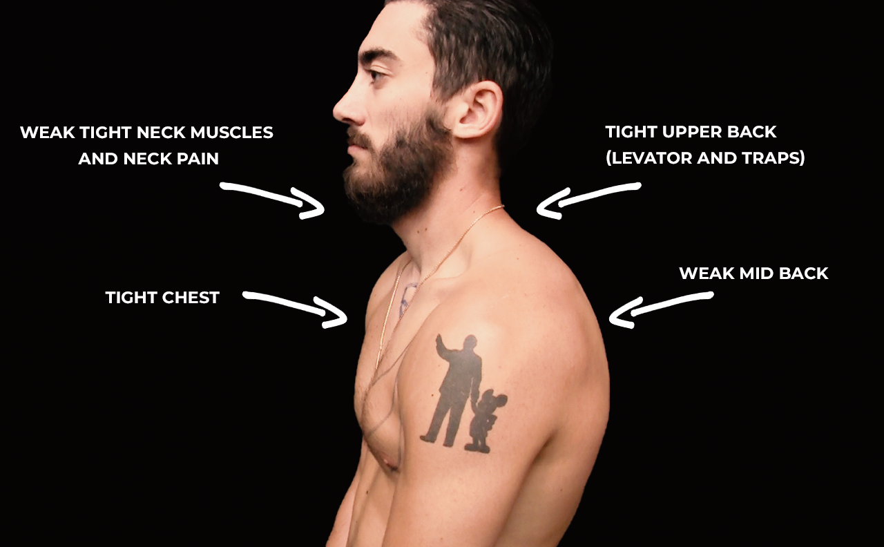 Correcting Rounded Shoulders