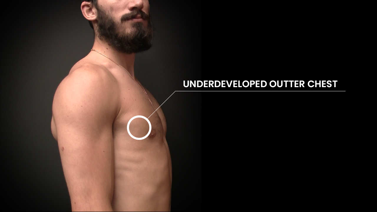 underdeveloped outer chest